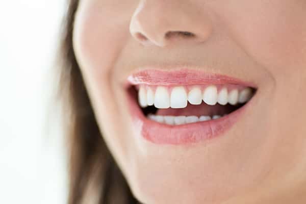 Teeth Whitening in 60453